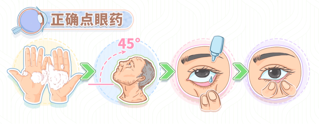 眼科小贴士，术后如何避免手术并发症？插图(3)