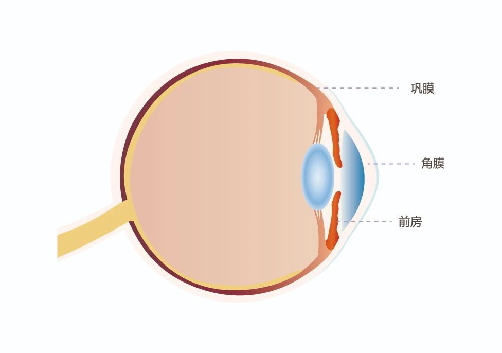 什么是角膜盲症？角膜难求怎么办？插图