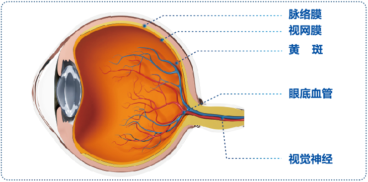 视网膜脱离的危害有多大？插图(1)
